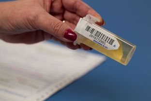 A medical technician handles and prepares urine sample to be tested for drugs at a small medical clinic in Austin.