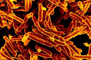 Scanning electron micrograph of Mycobacterium tuberculosis bacteria, which cause TB.