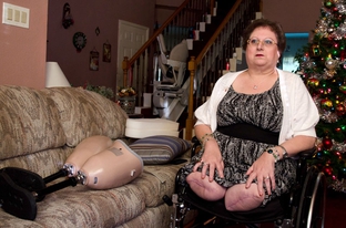 Connie Spears had to have both legs amputated above the knee, and blames an emergency room doctor for missing a critical diagnosis. The San Antonio woman's search for an attorney to take her case has been futile.