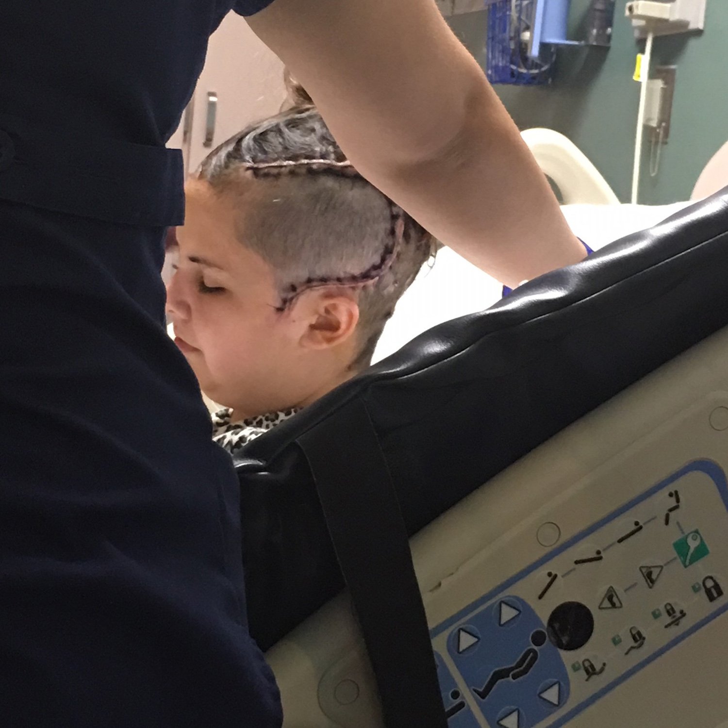 Sierra Cruz, 27, during her last long-term hospital stay. Cruz got intracranial monitoring to see if she was a candidate for brain surgery after prescription medication and a VNS implant failed to control her seizures. 